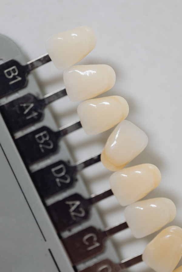 Oaks Dental-Stock Photo-Veneers Oaks Dental-Veneers