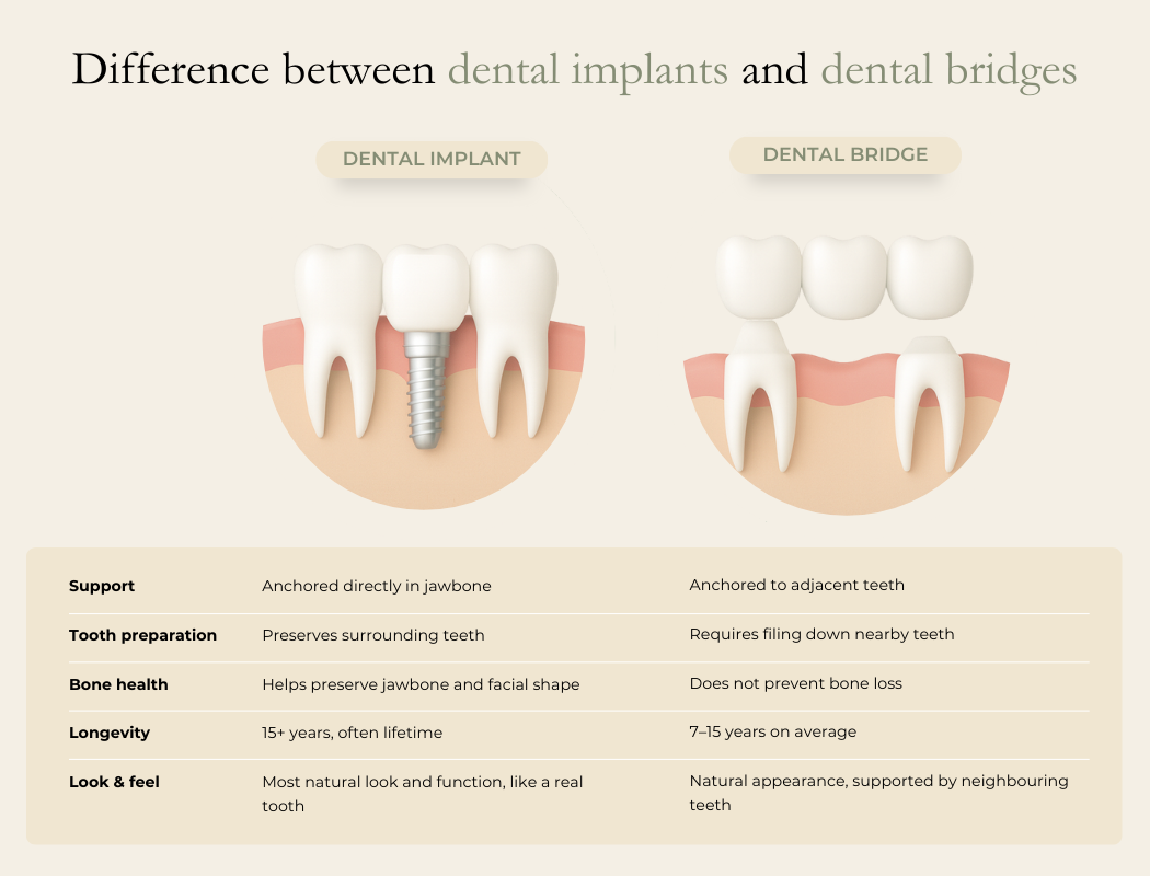 The Oaks Dental-Difference between dental implant and bridge The Oaks Dental neutral bay-Difference between dental implant and bridge
