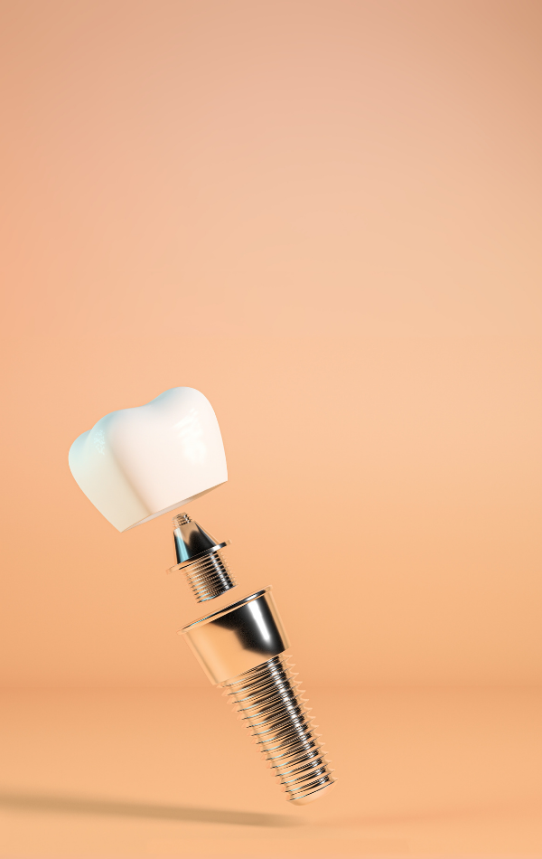 The Oaks Dental-website image-dental implant The Oaks Dental-website image-dental implant