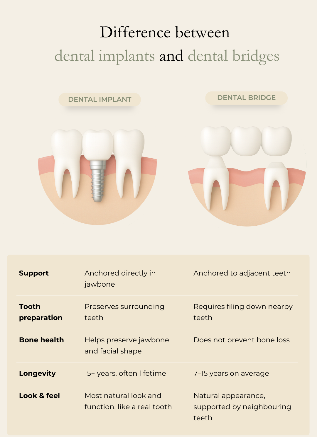 Difference between dental implant and bridge The Oaks Dental neutral bay-Difference between dental implant and bridge