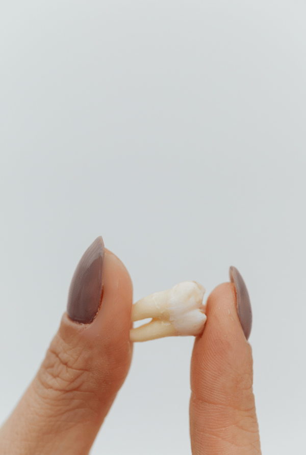 Website - Imagery (7) Oaks Dental-Neutral Bay-Dentist-Tooth Extraction
