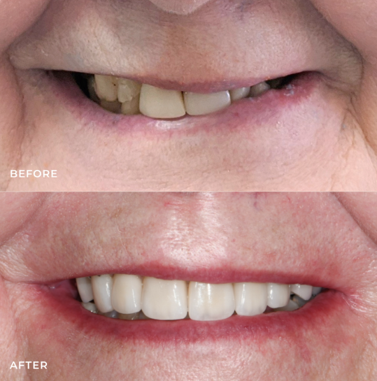 Screenshot 2025-10-12 015928 Oaks Dental Neutral Bay<br />