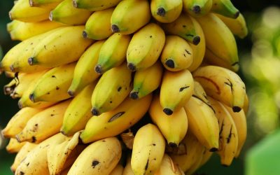 How Much Radiation Is in a Dental X-Ray? About 30 Bananas’ Worth
